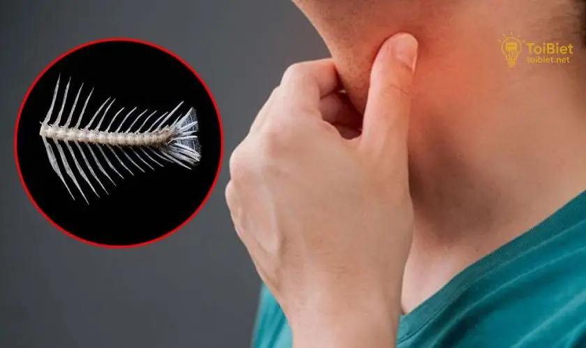 Cách Trị Hóc Xương Cá Ở Cổ Họng Tại Nhà Hiệu Quả 4 Khi Nào Cần Đến Bệnh Viện?