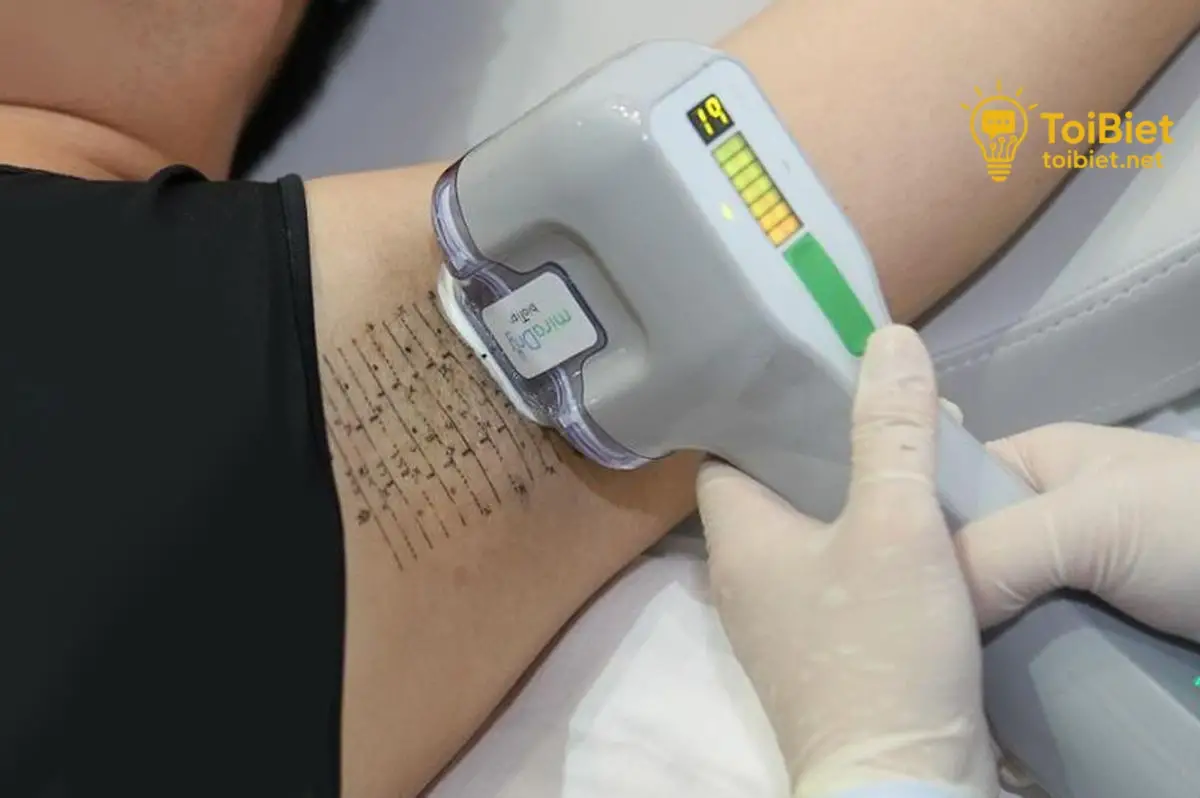 Sử Dụng Công Nghệ Miradry Hiện Đại và Bền Vững