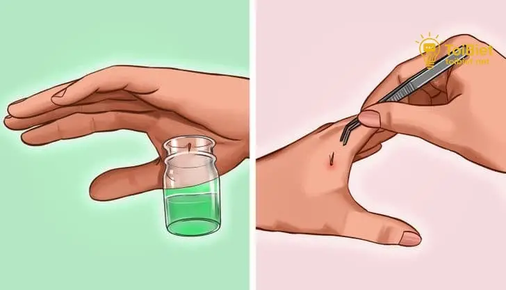 Khi Nào Cần Đến Bác Sĩ?