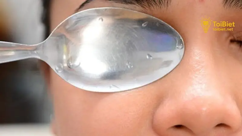 Quầng thâm mắt có thể xuất hiện do nhiều nguyên nhân khác nhau Quầng thâm mắt có thể xuất hiện do nhiều nguyên nhân khác nhau