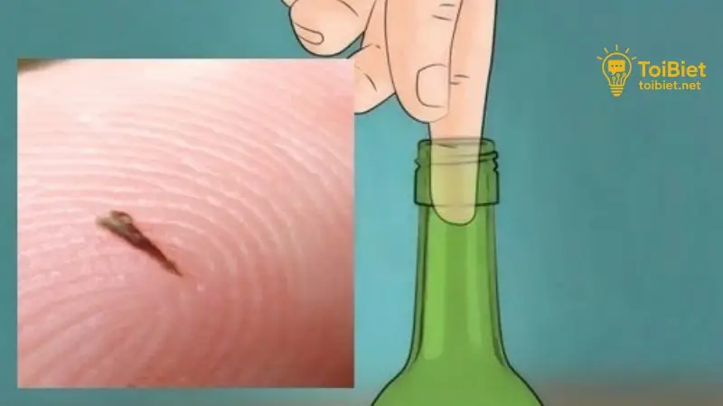 Mẹo Lấy Dằm Đâm Vào Tay Không Đau 15 Mẹo Lấy Dằm Đâm Vào Tay Không Đau