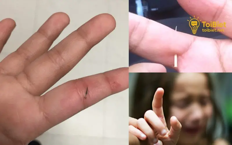 Các trường hợp cần đến gặp bác sĩ Các trường hợp cần đến gặp bác sĩ